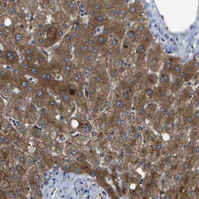 Immunohistochemistry-Paraffin: HFE Antibody [NBP1-83250]