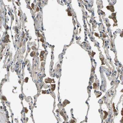 Immunohistochemistry-Paraffin: HFE Antibody [NBP1-83250]
