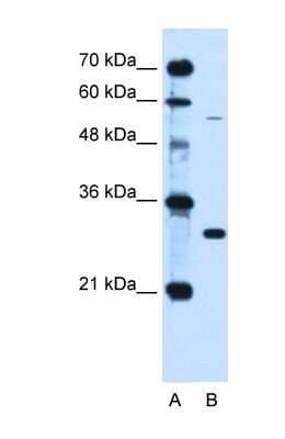 Western Blot: HFE Antibody [NBP1-59055]