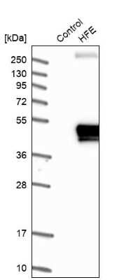 Western Blot: HFE Antibody [NBP1-83250]