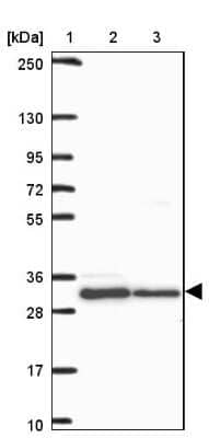 Western Blot: HFE Antibody [NBP2-38702]