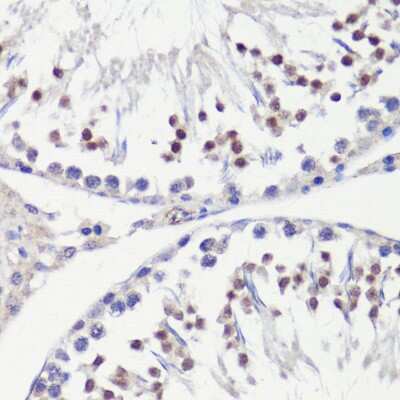 Immunohistochemistry-Paraffin: HFM1 Antibody - BSA Free [NBP3-04564]