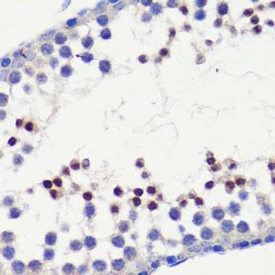 Immunohistochemistry-Paraffin: HFM1 Antibody - BSA Free [NBP3-04564]