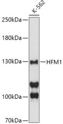 Western Blot: HFM1 AntibodyBSA Free [NBP3-04564]