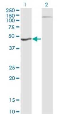 Western Blot: HGD Antibody (1F1) [H00003081-M11]