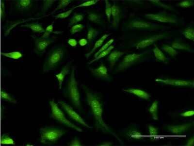 Immunocytochemistry/ Immunofluorescence: HGD Antibody (3G4) [H00003081-M10]