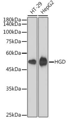 Western Blot: HGD Antibody (7O8Q1) [NBP3-15477]