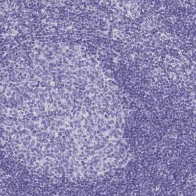 Immunohistochemistry-Paraffin: HGD Antibody [NBP2-49039]