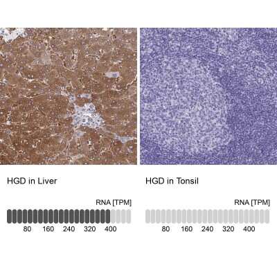 Immunohistochemistry-Paraffin: HGD Antibody [NBP2-49039]
