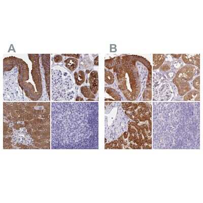 Immunohistochemistry-Paraffin: HGD Antibody [NBP2-49039]