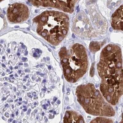 Immunohistochemistry-Paraffin: HGD Antibody [NBP2-49039]