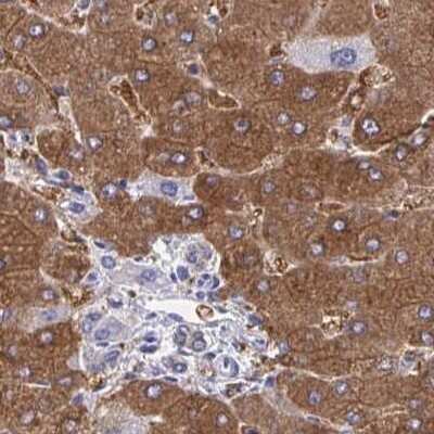 Immunohistochemistry-Paraffin: HGD Antibody [NBP2-49039]