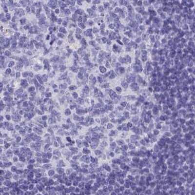 Immunohistochemistry-Paraffin: HGD Antibody [NBP2-49039]