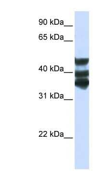 Western Blot: HGD Antibody [NBP1-55134]