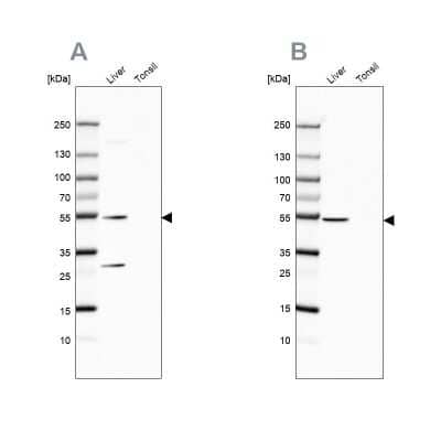 Western Blot: HGD Antibody [NBP2-33488]