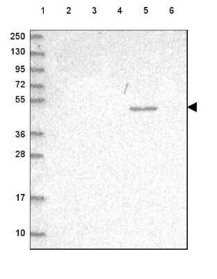Western Blot: HGD Antibody [NBP2-49039]