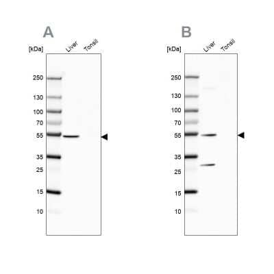 Western Blot: HGD Antibody [NBP2-49039]