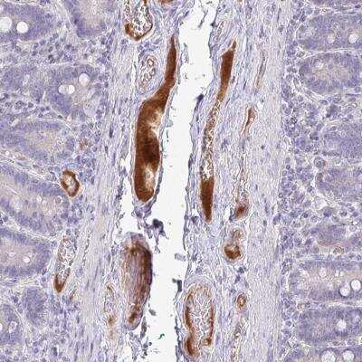 Immunohistochemistry-Paraffin: HGF Activator Antibody [NBP2-31710]