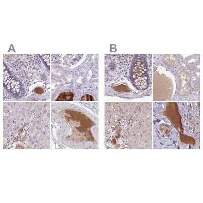 Immunohistochemistry-Paraffin: HGF Activator Antibody [NBP2-31710]
