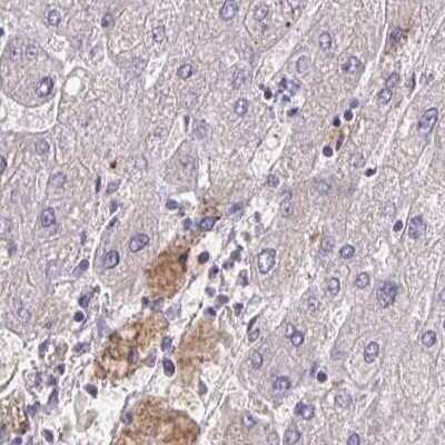 Immunohistochemistry-Paraffin: HGF Activator Antibody [NBP2-31710]