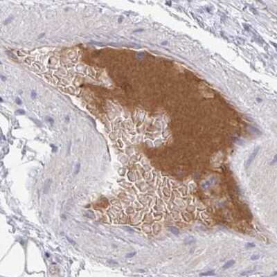 Immunohistochemistry-Paraffin: HGF Activator Antibody [NBP2-31710]