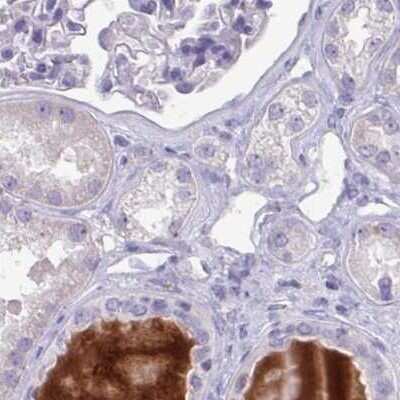 Immunohistochemistry-Paraffin: HGF Activator Antibody [NBP2-31710]