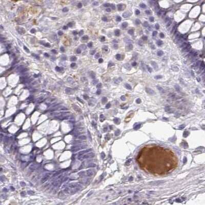 Immunohistochemistry-Paraffin: HGF Activator Antibody [NBP2-31710]
