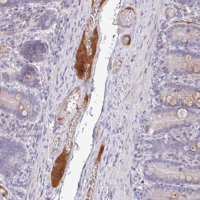 Immunohistochemistry-Paraffin: HGF Activator Antibody [NBP2-31741]