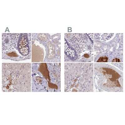 Immunohistochemistry-Paraffin: HGF Activator Antibody [NBP2-31741]