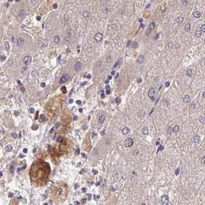 Immunohistochemistry-Paraffin: HGF Activator Antibody [NBP2-31741]