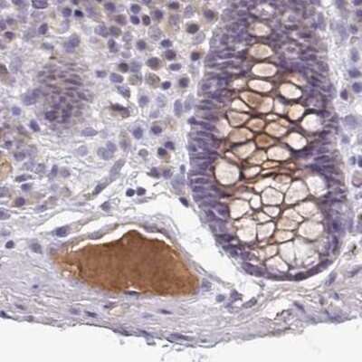 Immunohistochemistry-Paraffin: HGF Activator Antibody [NBP2-31741]
