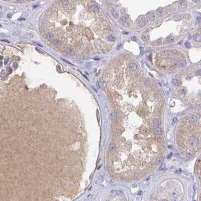 Immunohistochemistry-Paraffin: HGF Activator Antibody [NBP2-31741]