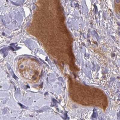 Immunohistochemistry-Paraffin: HGF Activator Antibody [NBP2-31741]