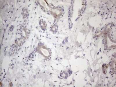 Immunohistochemistry: HGF Antibody (OTI1D2) [NBP2-45972]