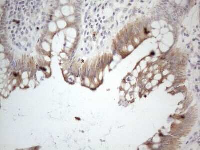 Immunohistochemistry: HGF Antibody (OTI1D2) [NBP2-45972]