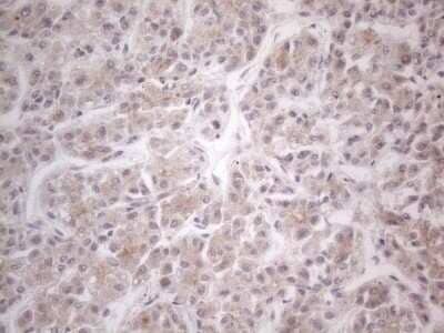 Immunohistochemistry: HGF Antibody (OTI1D2) [NBP2-45972]