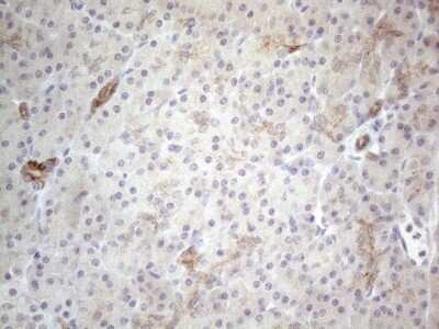 Immunohistochemistry: HGF Antibody (OTI1D2) [NBP2-45972]