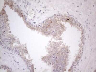 Immunohistochemistry: HGF Antibody (OTI1D2) [NBP2-45972]