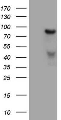 Western Blot: HGF Antibody (OTI1D2) [NBP2-45972]