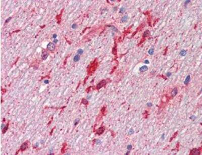 Immunohistochemistry-Paraffin: HGF Antibody (7-2) - BSA Free [NBP1-19182]