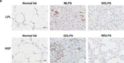 Immunohistochemistry-Paraffin: HGF Antibody (7-2) - BSA Free [NBP1-19182]