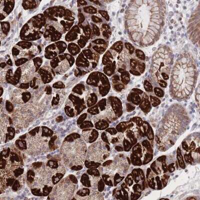 Immunohistochemistry: HGF Antibody [NBP2-48806]