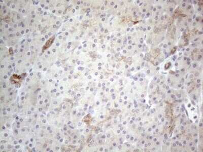 Immunohistochemistry: HGF Antibody (OTI1D2) - Azide and BSA Free [NBP2-70884]