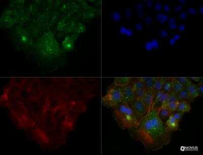Immunocytochemistry/ Immunofluorescence: HGFR/c-MET Antibody (1G7NB) - Azide and BSA Free [NBP2-44309]