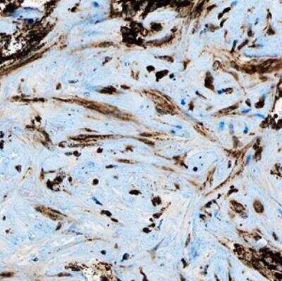 Immunohistochemistry-Paraffin: HGFR/c-MET Antibody (1G7NB) - Azide and BSA Free [NBP2-44309]
