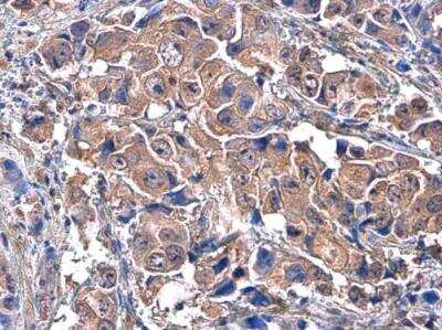 Immunohistochemistry-Paraffin: HGFR/c-MET Antibody (556) [NBP2-43641]