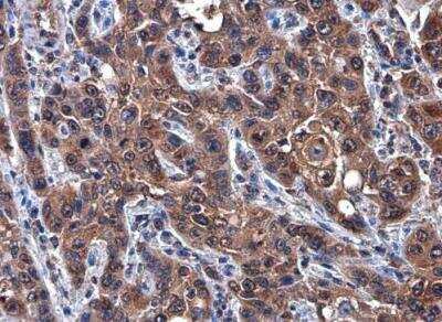 Immunohistochemistry-Paraffin: HGFR/c-MET Antibody (556) [NBP2-43641]