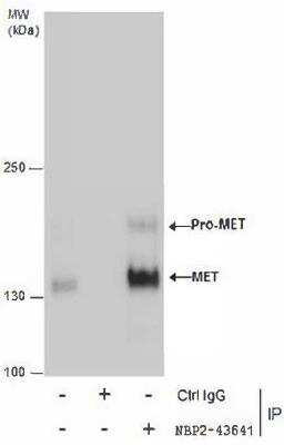 Immunoprecipitation: HGFR/c-MET Antibody (556) [NBP2-43641]
