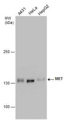Western Blot: HGFR/c-MET Antibody (556) [NBP2-43641]