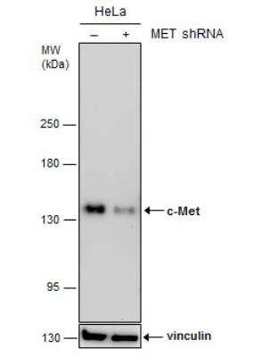 Western Blot: HGFR/c-MET Antibody (556) [NBP2-43641]